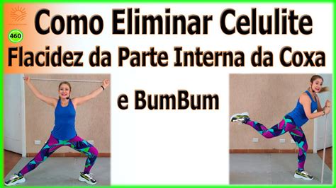 bundas com celulite|Como combater flacidez e celulite no bumbum